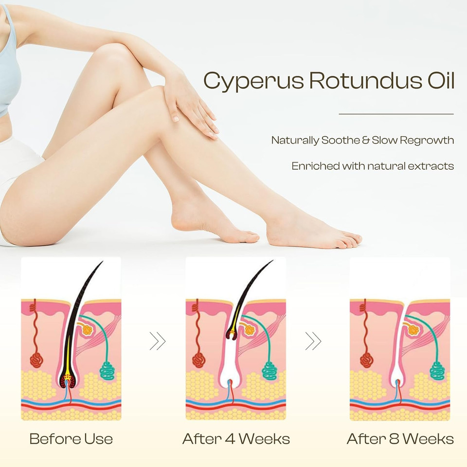 Cyperus Rotundus Oil For Hair Removal: Reduces Unwanted Hair Growth, Slows Regrowth, Soothes Skin & Shrinks Pores Suitable For All Skin Types (1.71 Fl Oz)