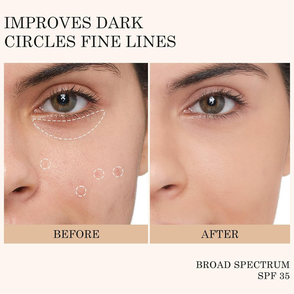 Kyda Mineral Sunscreen Eye Cream, 3-In-1 Anti-Aging Eye Cream, Spf 35, For Dark Circle And Fine Lines, Light