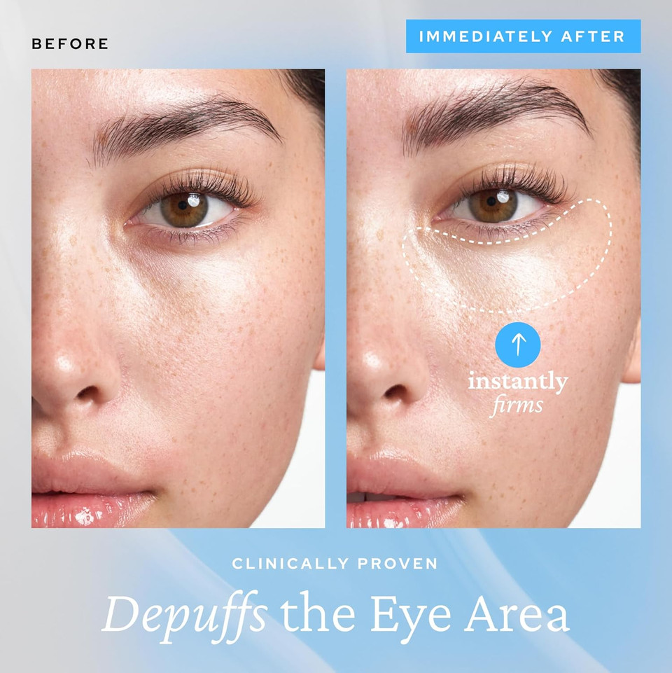 Belif Aqua Bomb Cooling Eye Gel - Caffeine & Hyaluronic Acid For Puffiness & Hydration, Niacinamide & Vitamin C For Dark Circles, Adenosine & Collagen For Plumping & Firming, Korean Skin Care