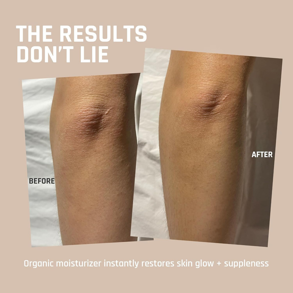 Whipped Beef Tallow For Skin - 100% Pure, Grass Fed Tallow Moisturizer For Face And Body - Organic Honey Beef Balm For Sensitive Skin - Quick Absorbing Hydration (Vanilla Cloud)