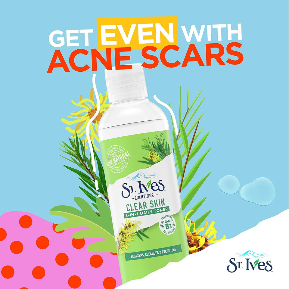 St.Ives Solutions 3-In-1 Face Toner For Combination To Oily And Acne Prone Skin Clear Skin Made With 100 Percent Natural Tea Tree Extract, Vitamin B3, Micellar Water Technology, And Witch Hazel 8.5 Oz