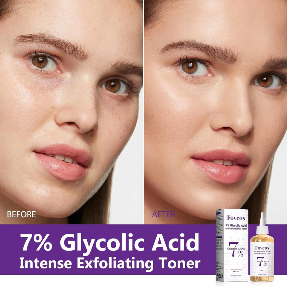 7% Glycolic Acid Toner, 7% Glycolic Acid Toner For Diminishing Acne Marks, Pore Tightening And Skin Hydration