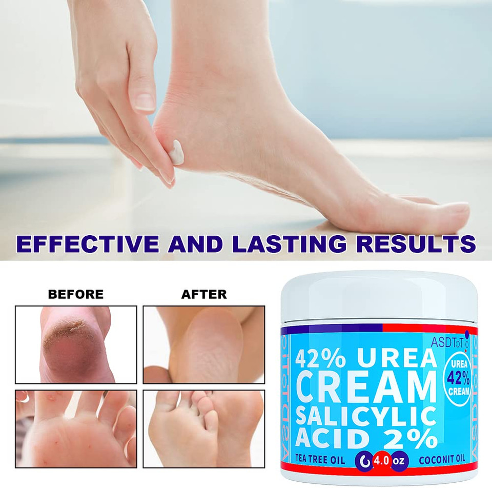 Urea Cream 42% - Premium Urea Foot Cream - With 2% Salicylic Acid, Tea Tree Oil, Shea Butter, Aloe Vera - For Feet, Hands, Heels, Elbows, Knees And More - 4 Oz Urea Cream 42% - Premium Urea Foot Cream - With 2% Salicylic Acid, Tea Tree Oil, Shea Butter, Aloe Vera - For Feet, Hands, Heels, Elbows, Knees And More - 4 Oz