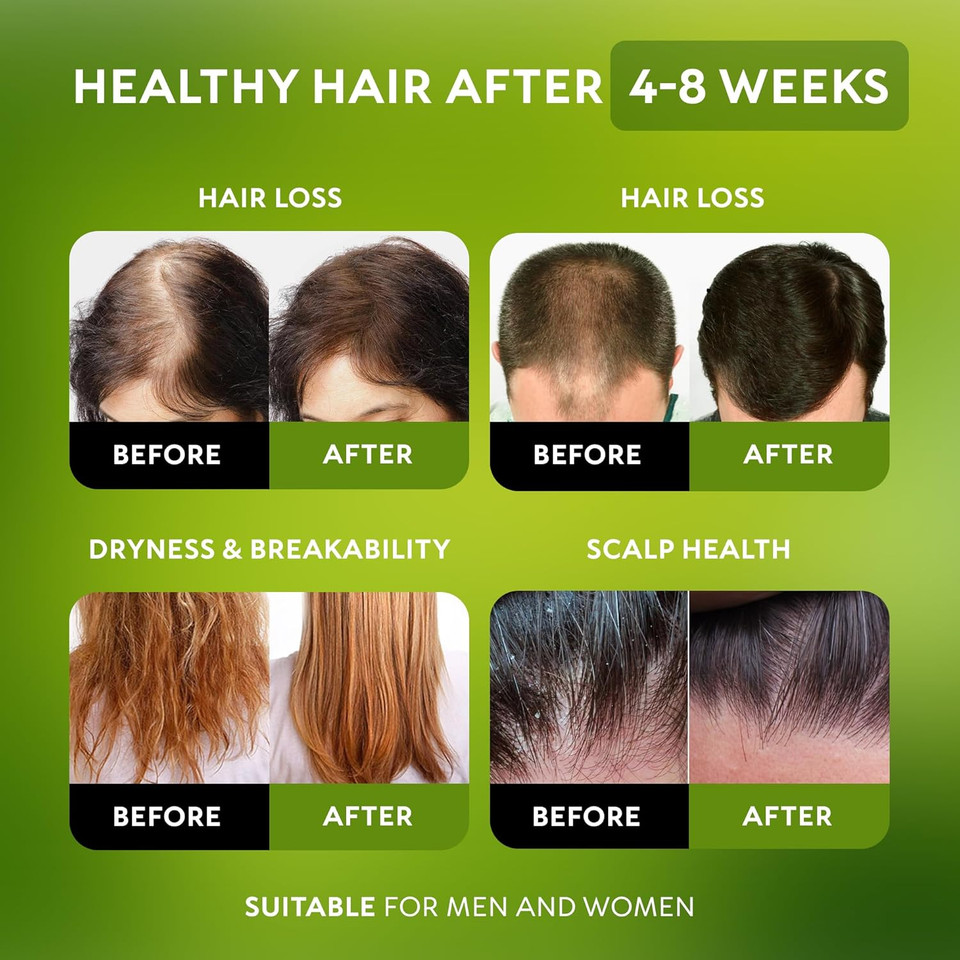 Batana Oil For Hair Growth - 100% Raw & Organic Dr Sebi Batana Oil - Cold-Pressed & Pure Unrefined Batana Hair Mask For Women & Men - Enhances Hair Thickness, Prevents Loss, Repairs Split Ends Batana Oil For Hair Growth - 100% Raw & Organic Dr Sebi Batana Oil - Cold-Pressed & Pure Unrefined Batana Hair Mask For Women & Men - Enhances Hair Thickness, Prevents Loss, Repairs Split Ends