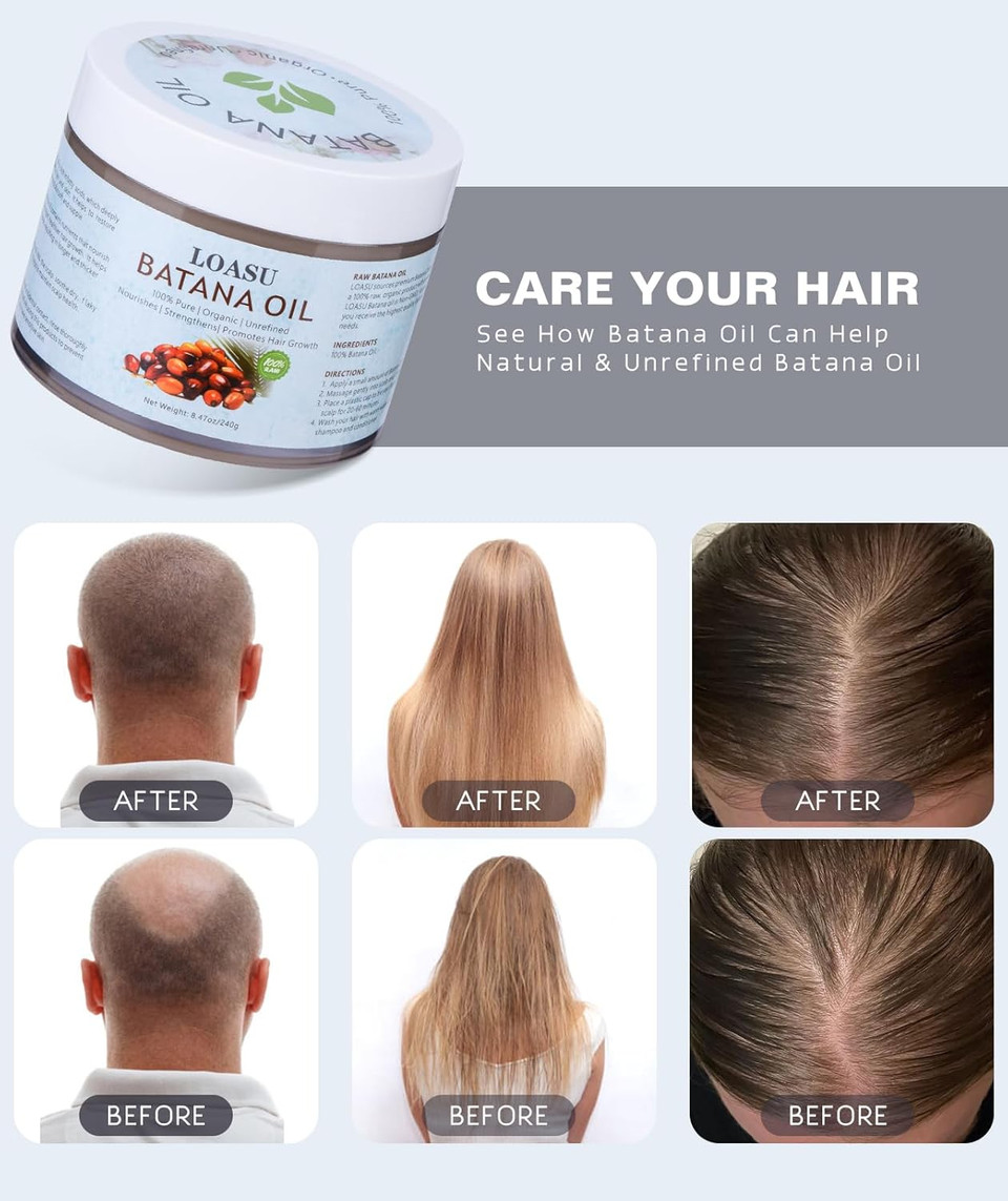 Dr Sebi Organic Batana Oil For Hair Growth - 100% Pure, Unrefined And Raw, Repairing Damaged Hair And Split Ends, Suitable For Men & Women, 8.43 Oz