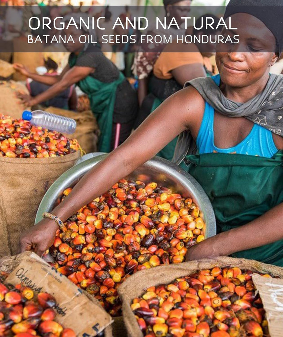 Dr Sebi Organic Batana Oil For Hair Growth - 100% Pure, Unrefined And Raw, Repairing Damaged Hair And Split Ends, Suitable For Men & Women, 8.43 Oz