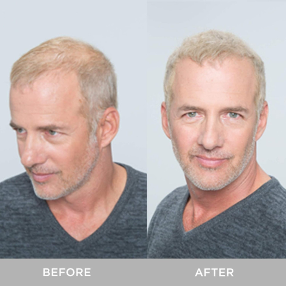 Xfusion Keratin Hair Fibers