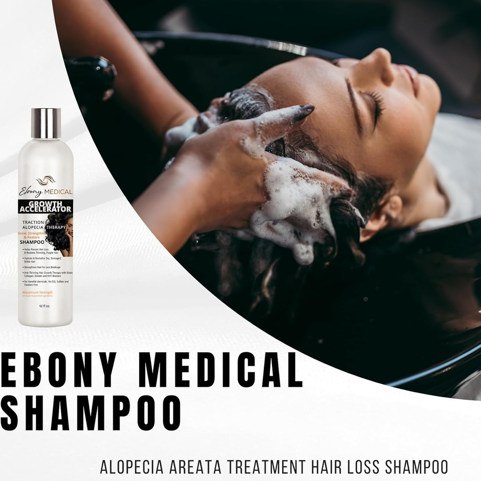 Ebony Medical Alopecia Areata Treatment Shampoo  Hair Loss & Thinning Hair Support  Stimulates Hair Growth & Scalp Health  Receding Hairline & Bald Spot Solution  12 Fl Oz  Natural & Vegan