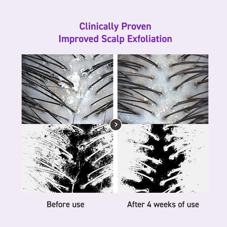 Dr.Oracle Seboclear Scalp Shampoo - Rebalancing Hair And Scalp, For All Hair Types. Biotin, Panthenol, Niacinamide, Salicylic Acid, Menthol