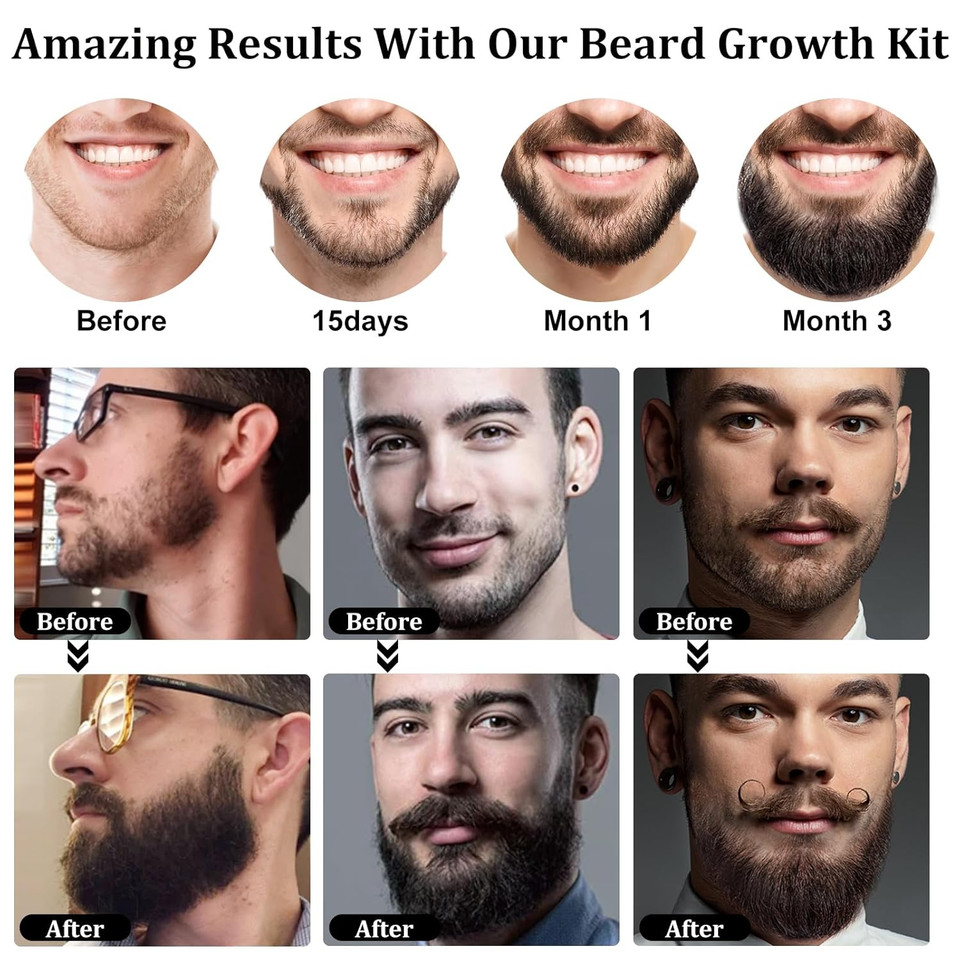 Raffin Beard Growth Kit For Men With Beard Growth Oil, Balm, Comb, Massager For Spot/Patchy Facial Hair, Achieve Fuller, Thicker & Healthier Beards, Gifts For Him Boyfriend Husband Dad