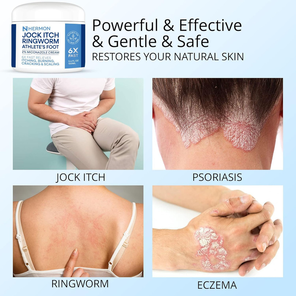 Jock Itch Antifungal Cream, Ringworm Treatment For Humans, Psoriasis Treatment, Psoriasis Scalp Treatment, Ringworm Cream For Humans, Foot & Body Balm, Provides Soothing Relief-100G