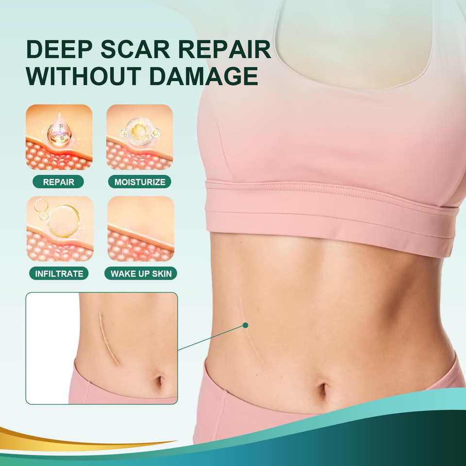 Medical Grade Silicone Scar Sheets, Silicone Scar Tape (1.6X 60 Roll-1.5M), Professional Scar Removal Treatment, Reusable Silicone Scar Strip For Keloid, C-Section, Surgery, Burns, Acne Etc