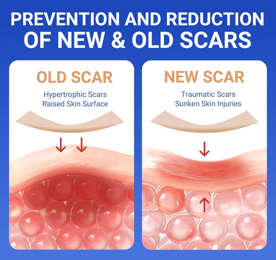 Silicone Scar Sheets Surgical Tape (1.6X120 Roll) Face Patches Acne Treatment C Section Strips, Skin-Sensitive Medical Grade Healing Scar Bandages Pads For Keloid, Stretch And Tummy Tuck Recovery