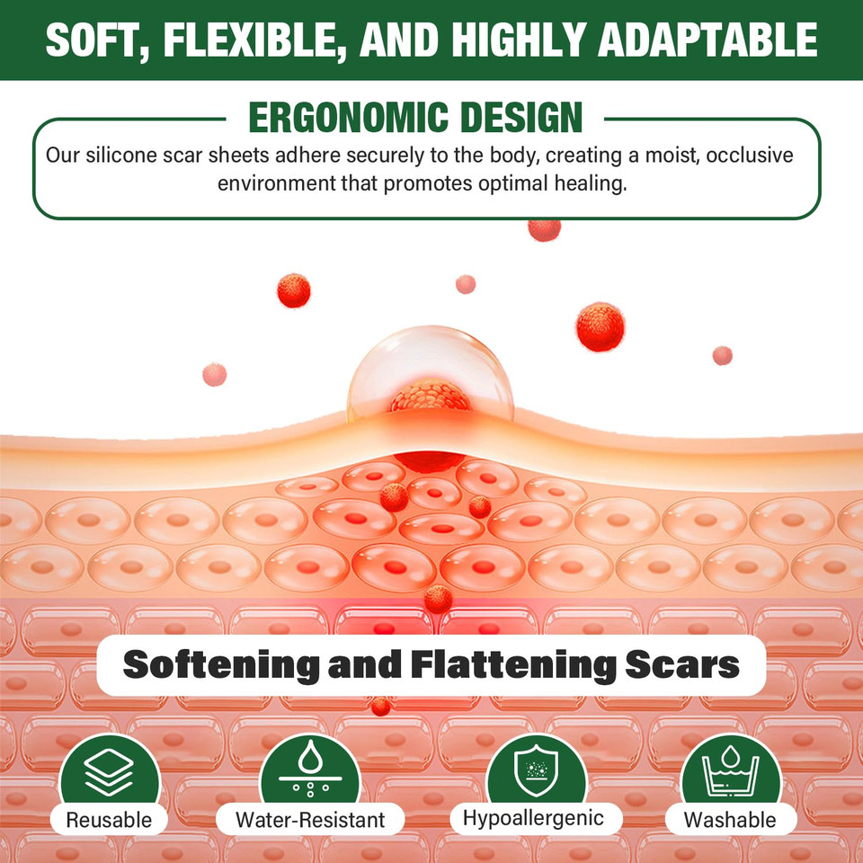 Silicone Scar Sheets,Silicone Scar Tape,Silicone Sheets For Scars,Scar Tape For Surgical Scars,Keloid Bump Removal,Scar Removal For Surgical(1.6"X 120" Roll-3M)