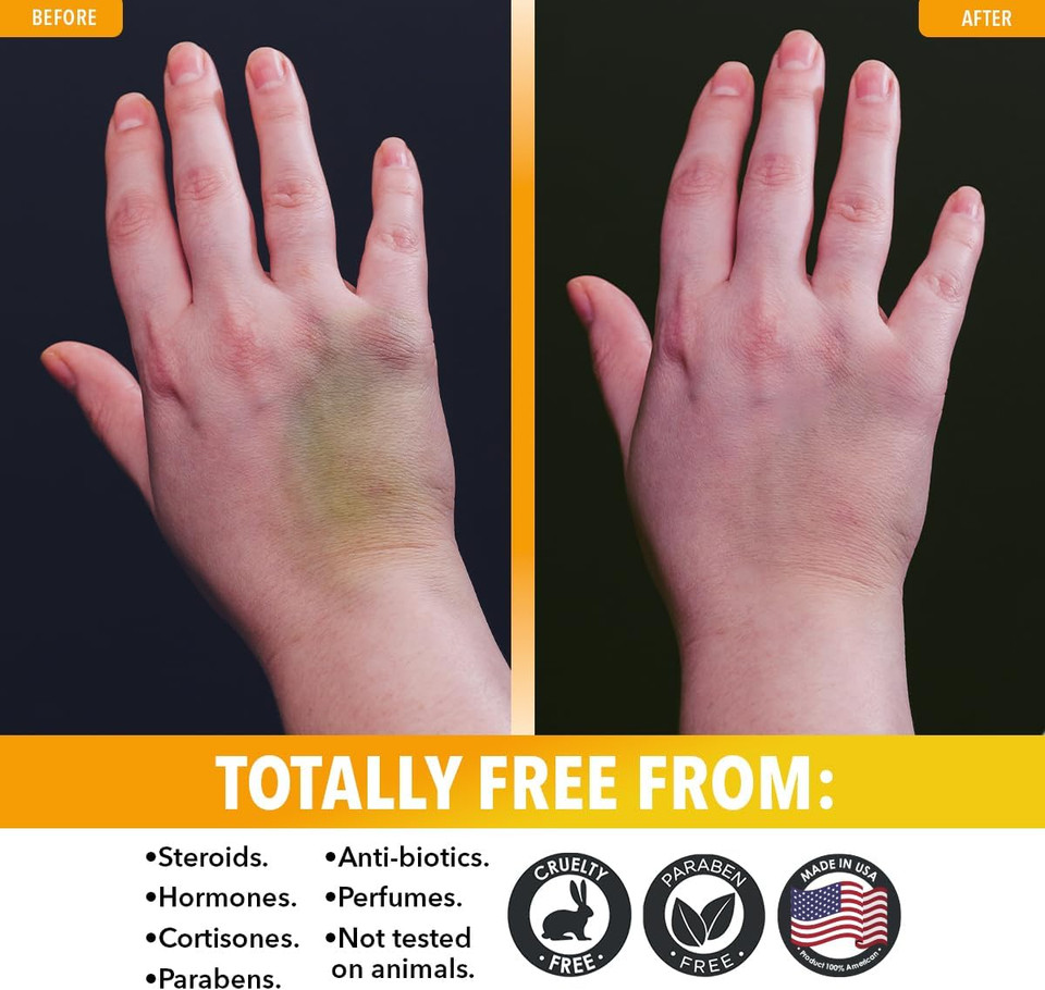 Dr. Robaina Arnica Gel 4 Oz  Concentrated Arnica Montana With Msm, Magnesium & Vitamin E | Unscented Cooling Gel For Thin Skin & Bruised Areas | Fast-Absorbing, Non-Greasy | Made In Usa