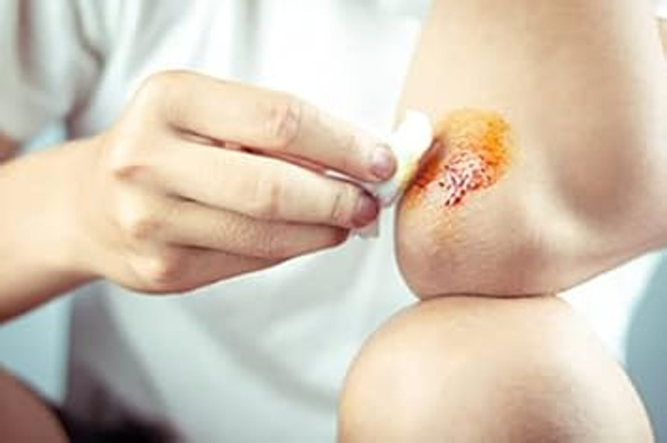 Dragon'S Blood Original,100% Peruvian 2 Oz Concentrate, Sangre De Drago, Sangre De Grado