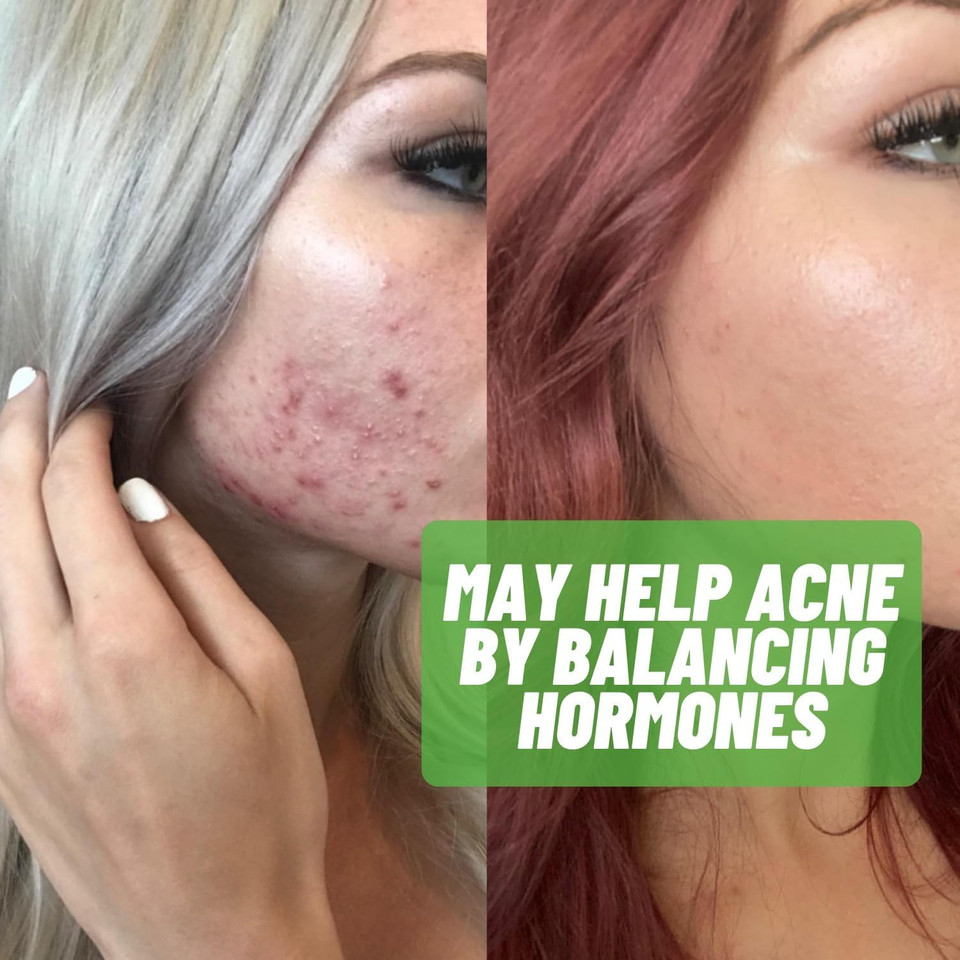 Estrogen-Blocker Supplement & Natural Anti Aromatase Inhibitor Pills For Men & Women Dim (Diindolylmethane) & Indole 3 Carbinol (I3C) Supplements For Estrogen Dominance & Hormone Balance Estrogen-Blocker Supplement & Natural Anti Aromatase Inhibitor Pills For Men & Women Dim (Diindolylmethane) & Indole 3 Carbinol (I3C) Supplements For Estrogen Dominance & Hormone Balance