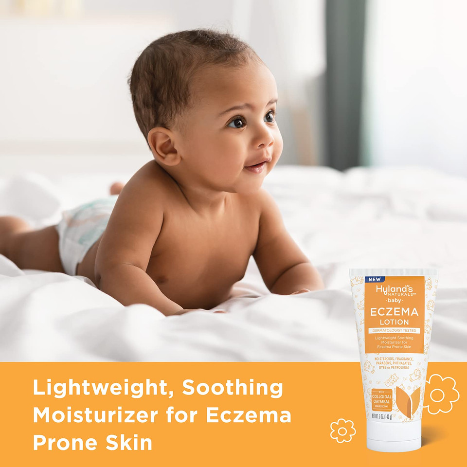 Hyland'S Baby Eczema Lotion, Lightweight Soothing Moisturizer For Eczema Prone Skin, With Colloidal Oatmeal, 5 Ounce