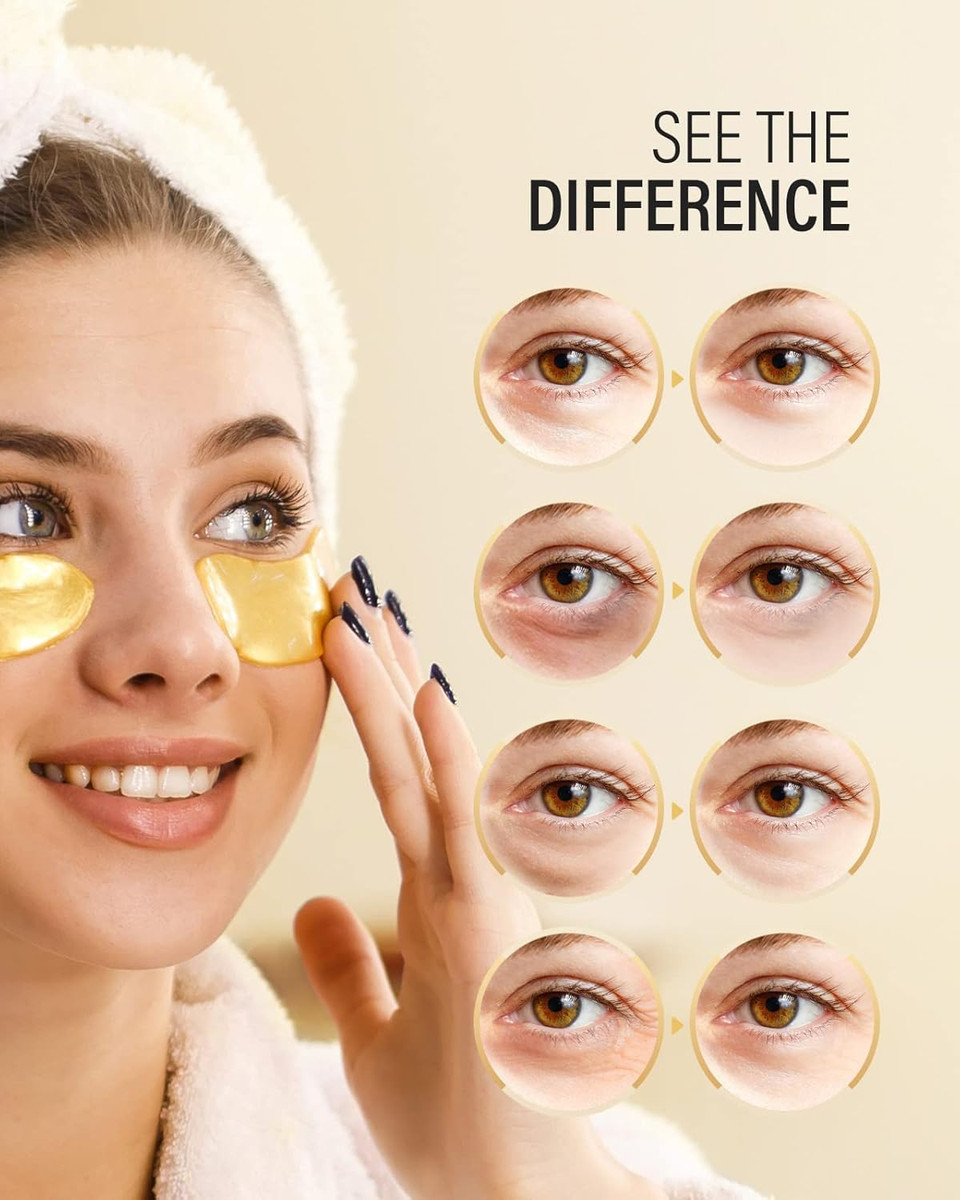 Under Eye Patches (30 Pairs), Hyaluronic Acid Eye Masks For Dark Circles Puffy Eyes Undereye Bags, Collagen Eye Patches For Wrinkles And Hydrate, Skin Care Gift For Her