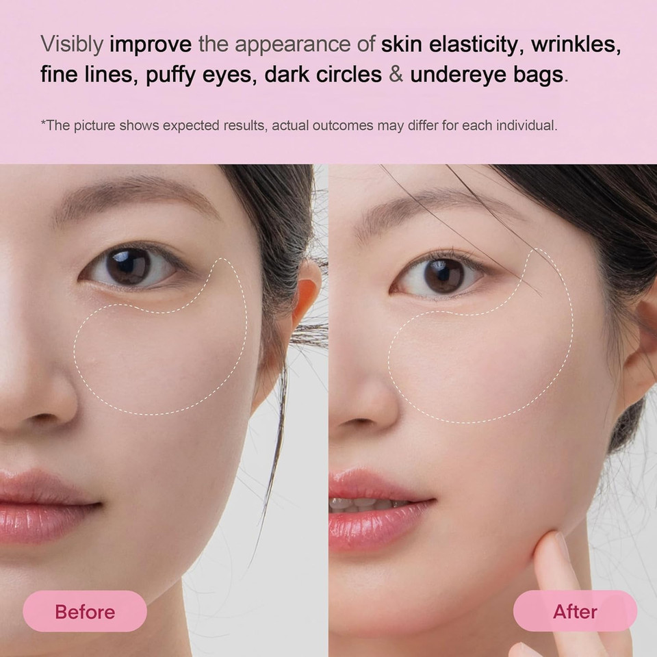 Terez & Honor Vitamin C Eye Patches - Brightening & Glowing Under Eye Mask With Tranexamic Acid, Caffeine, Hyaluronic Acid - Dark Circles, Puffiness & Wrinkles Korean Hydrogel Treatment, 60 Pcs