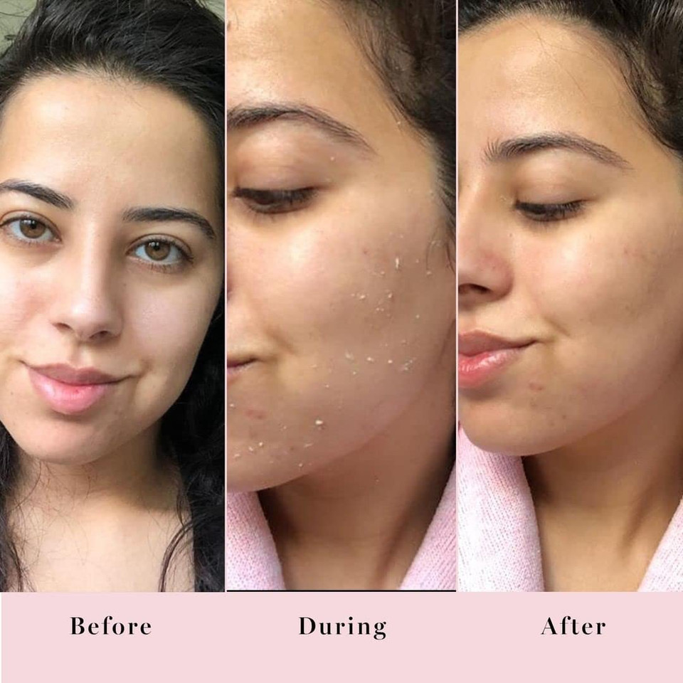 Saturday Skin Rub-A-Dub Refining Peel Gel Facial Cleansing Gels Facial Cleansing Washes Natural Fruit Enzymes Mild Cleanser Exfoliating Great For Sensitive Skin (2.53 Fl. Oz. (75Ml))
