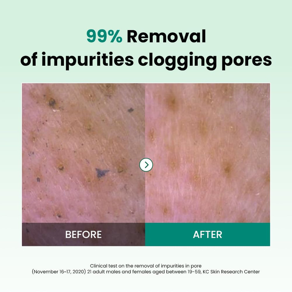 Dr.G Ph Cleansing Gel Foam, 200Ml - Gel Cleanser Face Wash, Gel Face Wash, Korean Skin Care Coreano, Korean Skincare, K Beauty Skincare, Kbeauty Skincare, Korean Beauty, Asian Skin Care Coreano