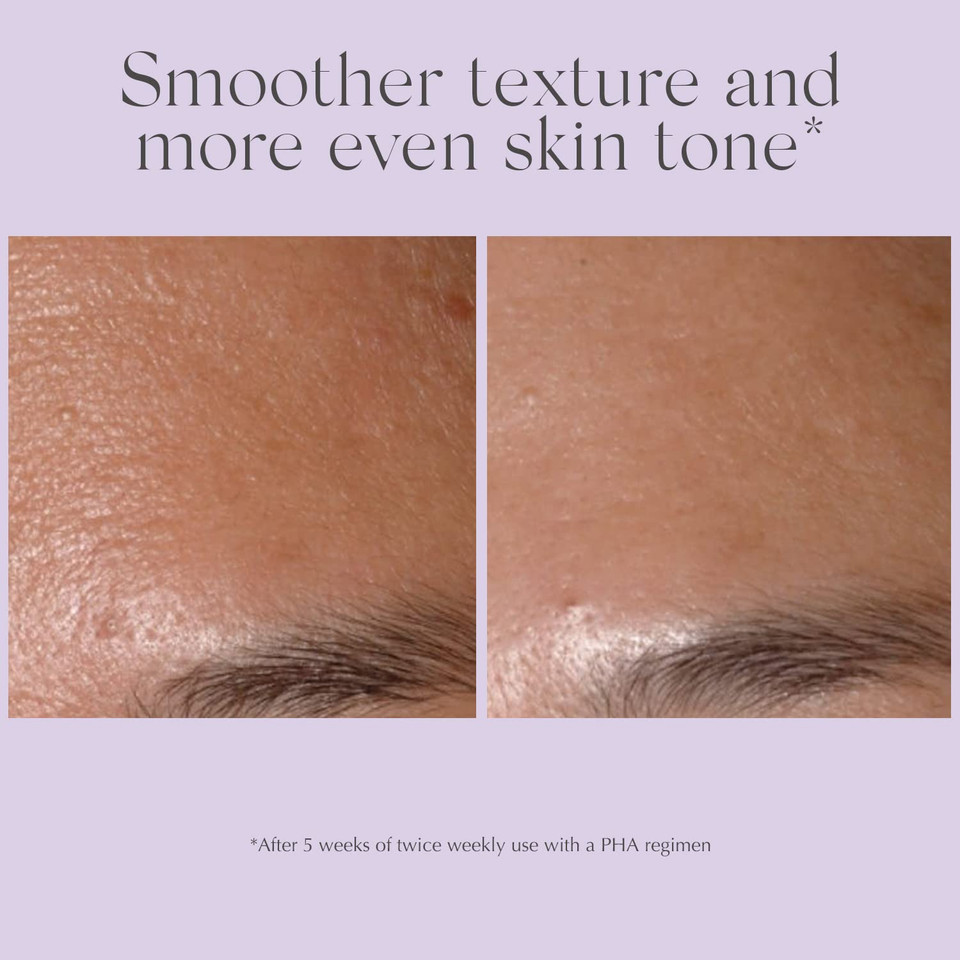 Exuviance Performance Peel Ap25, At-Home Chemical Peel With Glycolic Acid, Gently Refines Pores, Anti-Aging Peel, Treats Fine Lines, Wrinkles & Uneven Texture|Mandelic And Polyhydroxy Acids