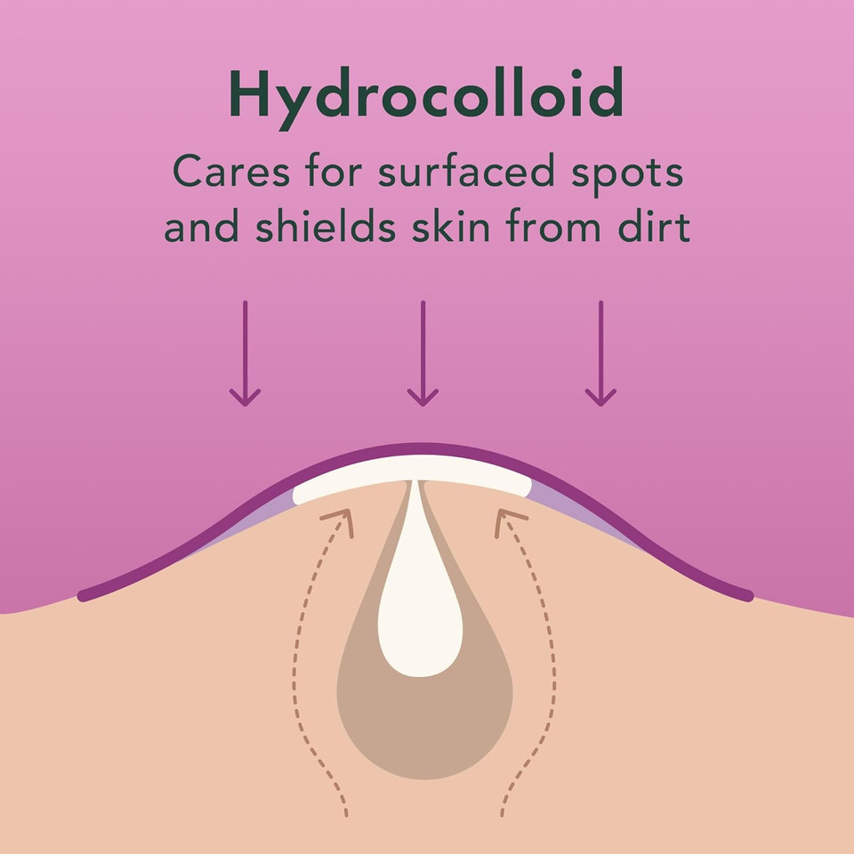 Rael Pimple Patches - Miracle Overnight Spot Cover, Thicker & Extra Adhesion, Hydrocolloid Acne Treatment For Face, Zits & Blemishes, Korean Skin Care, Vegan & Cruelty-Free, 3 Sizes (104 Count)