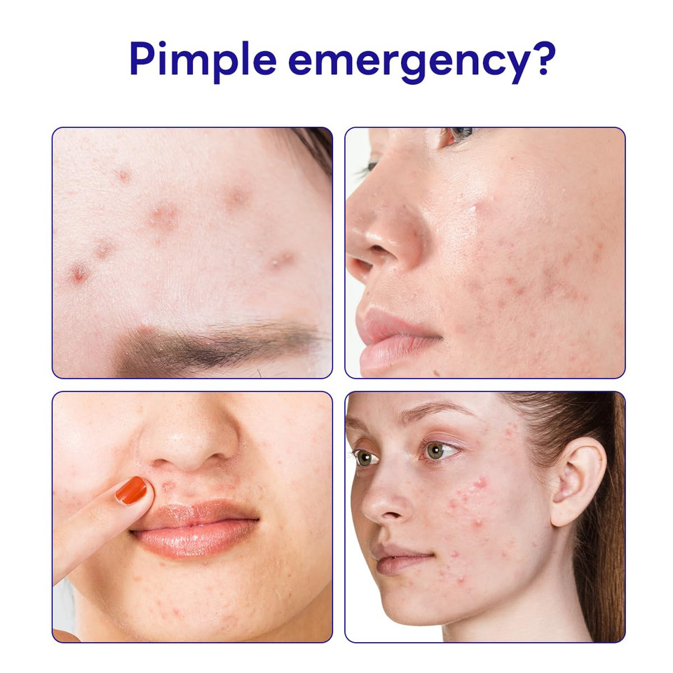 Mediheal Derma Clear Teatree Treatment Spot Patch (132 Counts) - Acne Relief, Oil And Moisture Balance With Teatree & Salicylic Acid