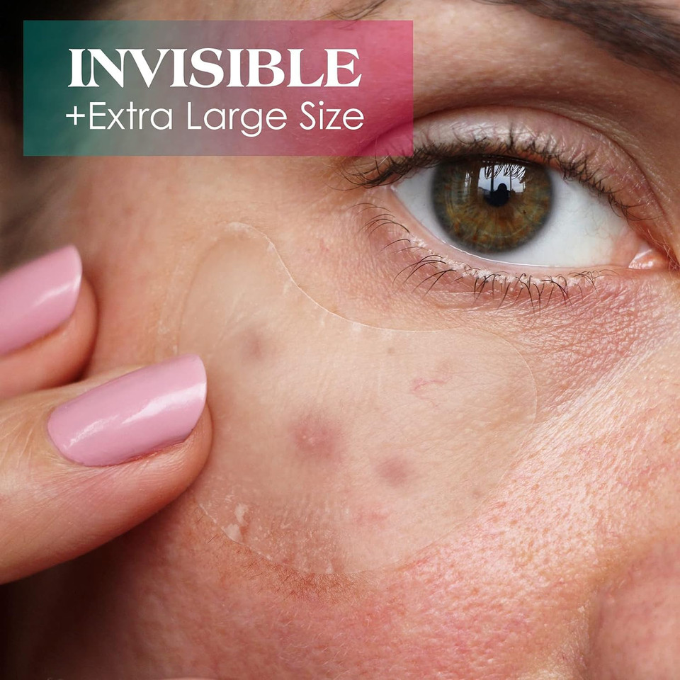 Auslka Pimple Patches For Face,Large Hydrocolloid Patches, Zit & Blemish, Large Spot Stickers For Chin, Cheeks, Body With Tea Tree & Calendula Oil, 18 Count