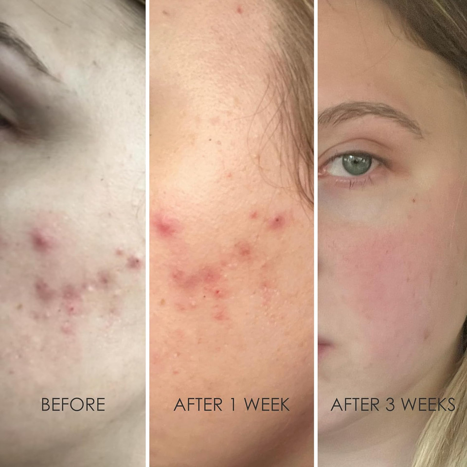 Reflekt 2 Collagen Boost Vitamin C Serum