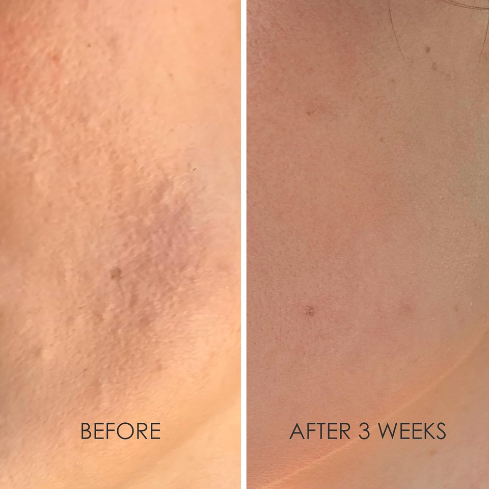 Reflekt 2 Collagen Boost Vitamin C Serum