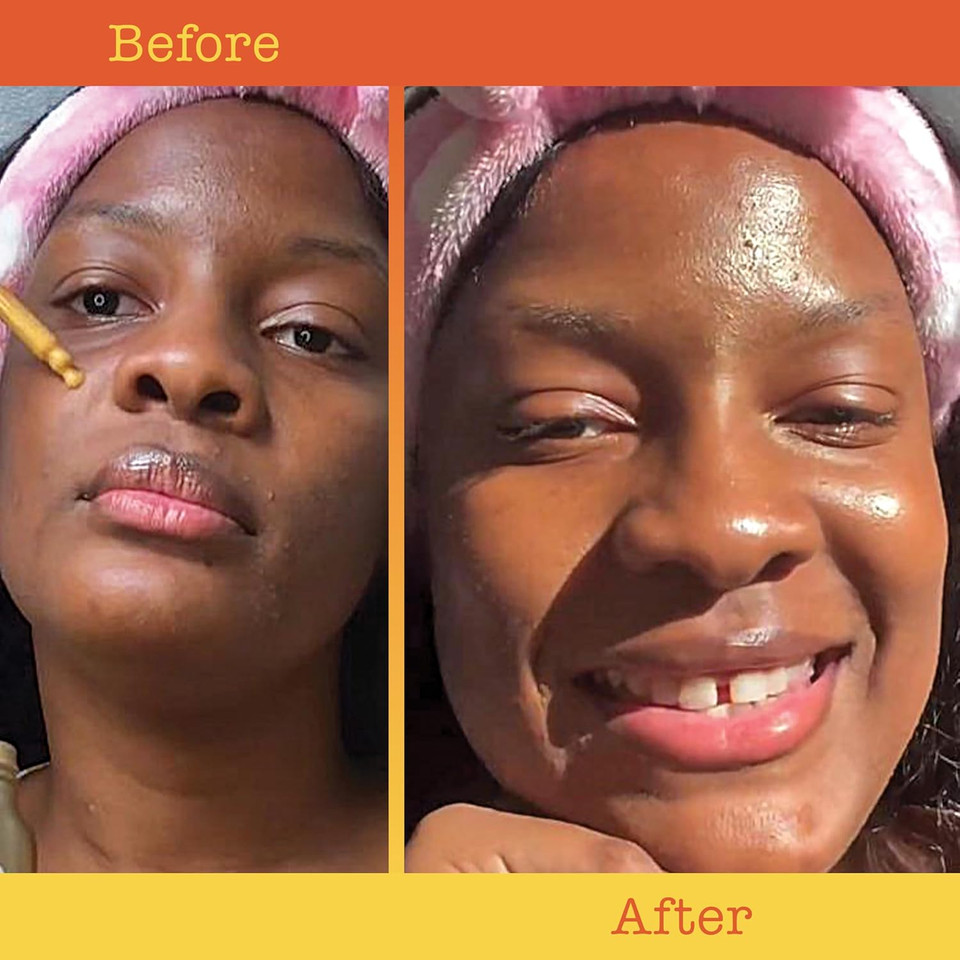 Shimmer Drops W/Turmeric & Niacinamide: Nourishing Serum For A Subtle Sun-Kissed Face Or Body Glow, 2 Fl. Oz