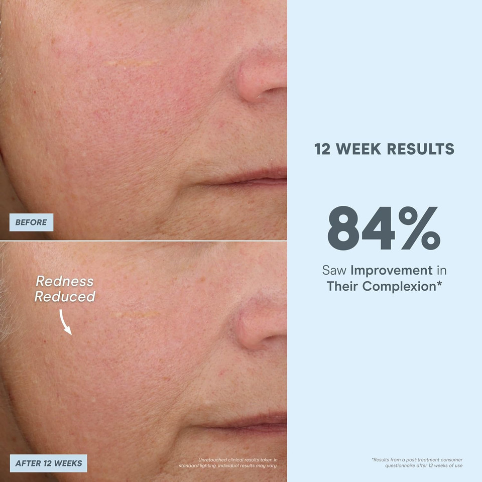 Nuface Antioxidant Serum - Facial Firming, Smoothing & Tightening Serum To Shield And Protect Against Blue Light - Multi-Use Skincare & Super Booster For Nuface Microcurrent Device Results (1 Oz)