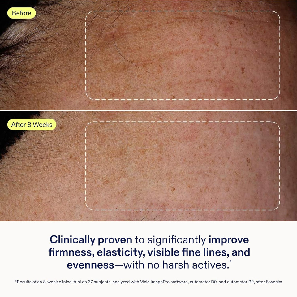 Skinfix Exo + Ectoin Intensive Repair Baume - 1 Oz - Retinol-Free Face Serum - Visibly Smooths Wrinkles + Evens Dark Spots And Redness - Fragrance Free - Vegan, Cruelty Free