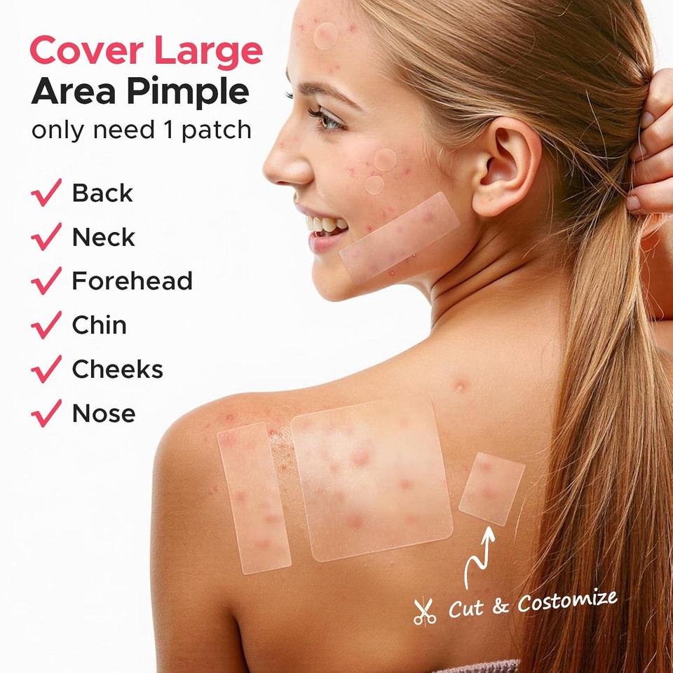 Litbear Large Pimple Patches, 5 Sizes 212 Counts Big Acne Patches For Face, Forehead, Body And Back, Hydrocolloid Bandages For Zits, Blemishes And Large Breakouts, Hydrocolloid Patch Pimple Stickers