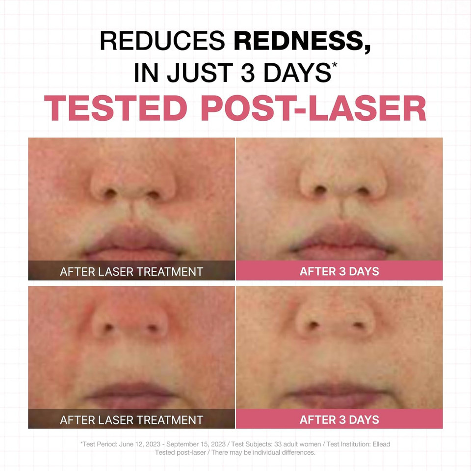 Physiogel Moisturizer Cream, Reduces Redness In Just 3 Days, Hydration For Dry & Sensitive Skin, Korean Skin Care, Fragrance-Free, Non-Comedogenic, Dermatologist-Tested, Lightweight Night Cream