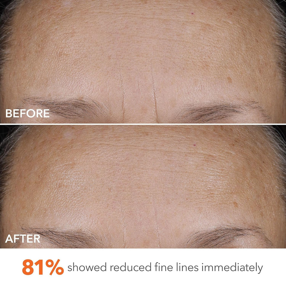 Dr Dennis Gross Derminfusions Blur + Repair Cream, Instantly Blurs Fine Lines, Smooths Skin With Satin-Matte Finish, Visibly Plumps & Firms & Improves Skin Elasticity, 0.67 Fl Oz