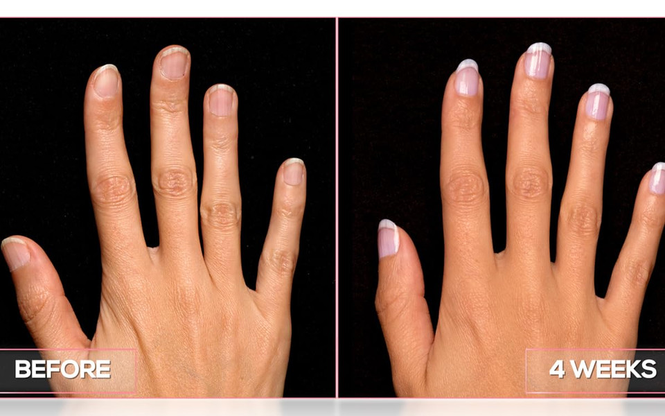 Perfect Formula Manicure Booster - Base And Top Coat Nail Strengthener, Keratin Treatment - Strengthener For Damaged Nails - Made In The Usa .60 Fl Oz
