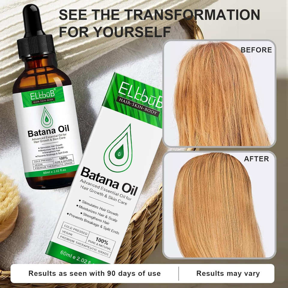 Dr. Sebi Raw Batana Oil - Hair Growth Oil For Men & Women, Sourced From Honduras, Pure & Unrefined, Nourishing Scalp & Hair, Promotes Hair Thickness, Prevents Hair Loss