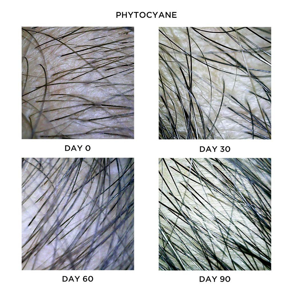 Phytocyane Women Treatment Reactional Hair Thinning