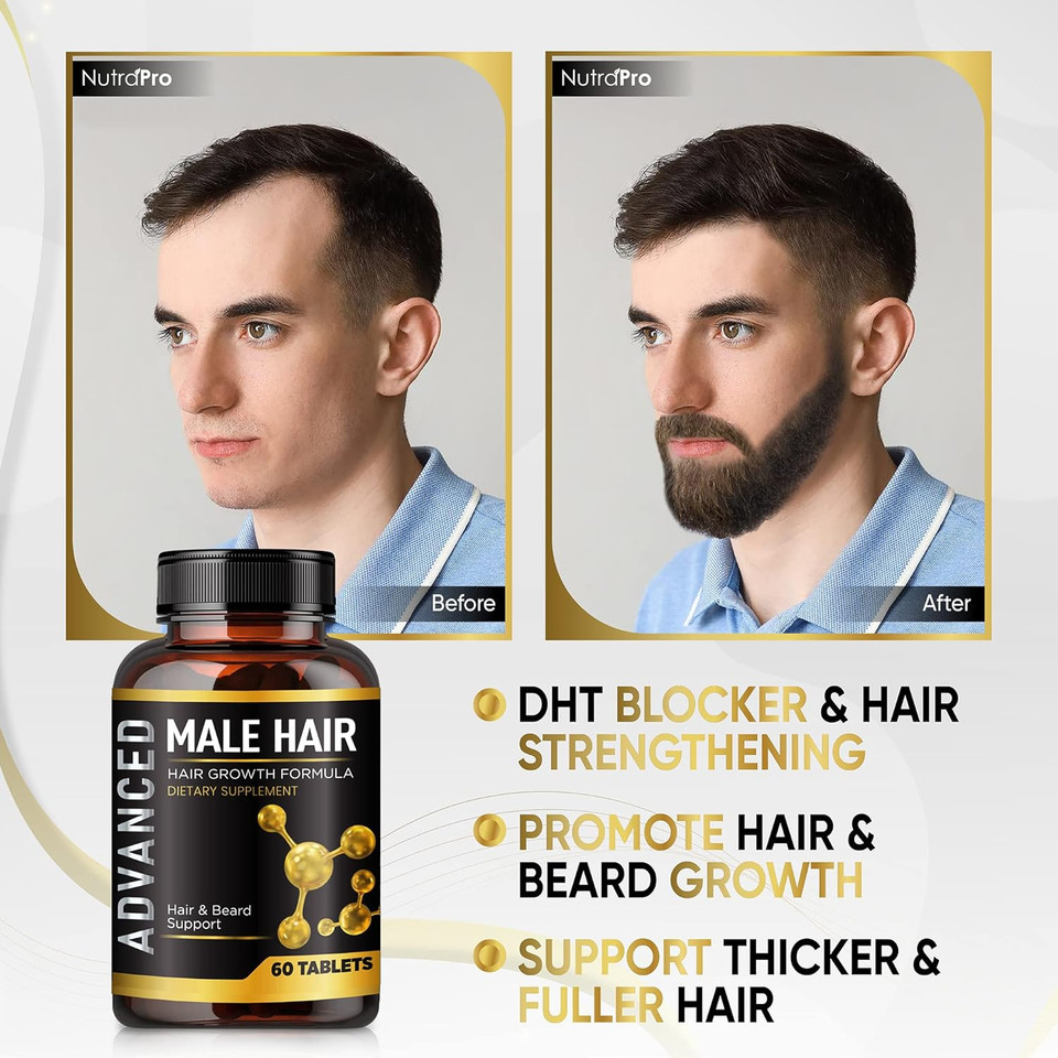 Hair Growth Vitamins For Men-Anti Hair Loss Support Vitamins Pills & Dht Blocker For Men.Regrow Hair & Beard Growth Supplement For Thicker Fuller & Stronger Hair. Support Thinning Hair With Biotin