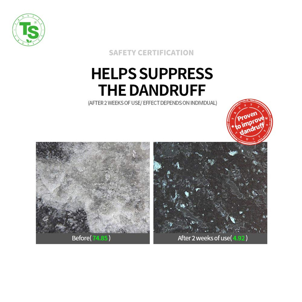 All New Plus Ts Shampoo With Biotin For Hair Loss Prevention | Therapy Shampoo For Damaged Hair | Korea Hair Care For Men & Women (16.9 Fl Oz)