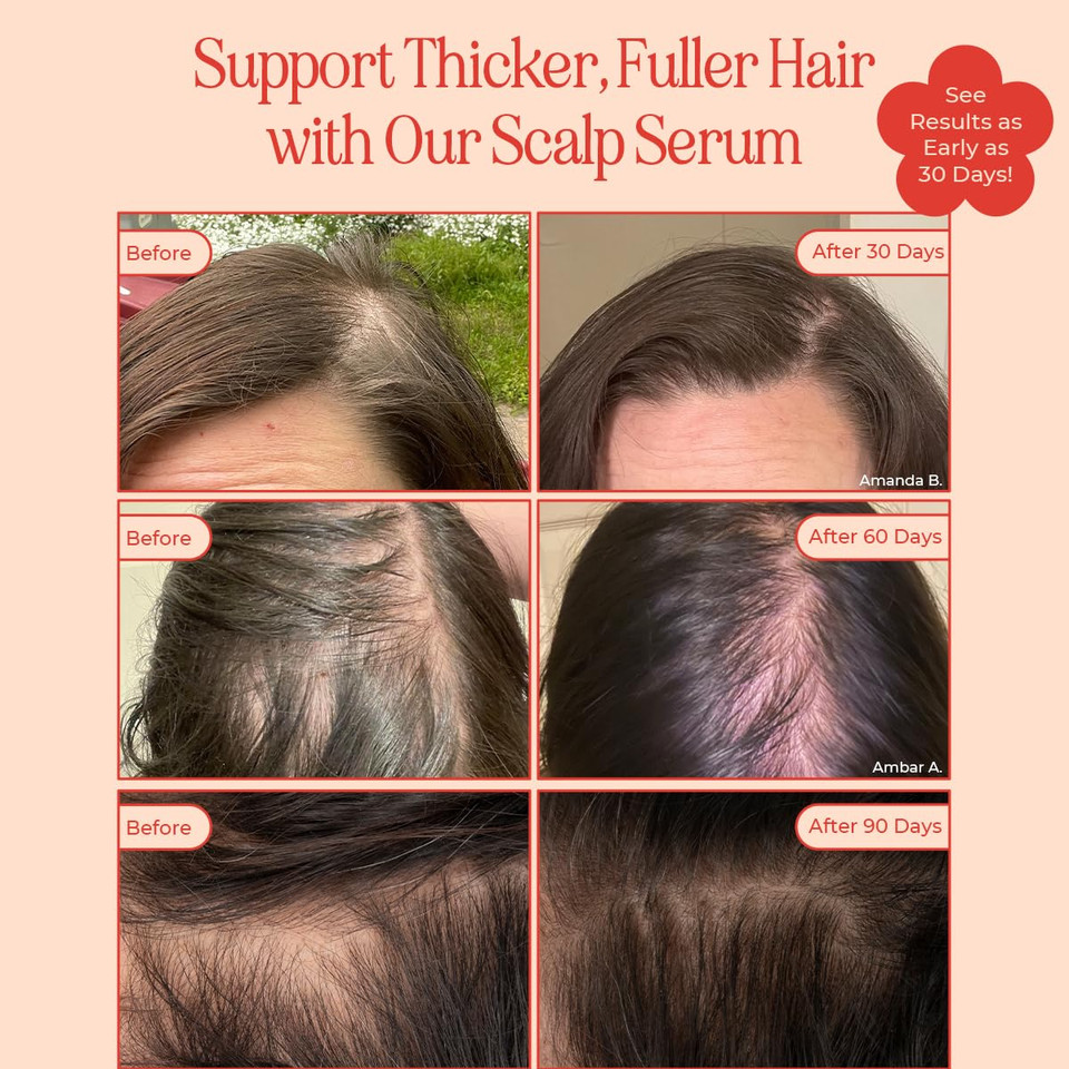 Inh Hair Serum | G2G Biotin & Caffeine Scalp Treatment That Supports Natural Hair Growth | Non Comedogenic Follicle Stimulator & Multi-Peptide Serum For Hair Density & Strengthening | 30-Day Supply