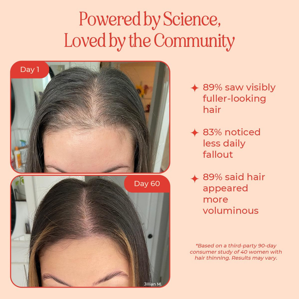 Inh Hair Serum | G2G Biotin & Caffeine Scalp Treatment That Supports Natural Hair Growth | Non Comedogenic Follicle Stimulator & Multi-Peptide Serum For Hair Density & Strengthening | 30-Day Supply