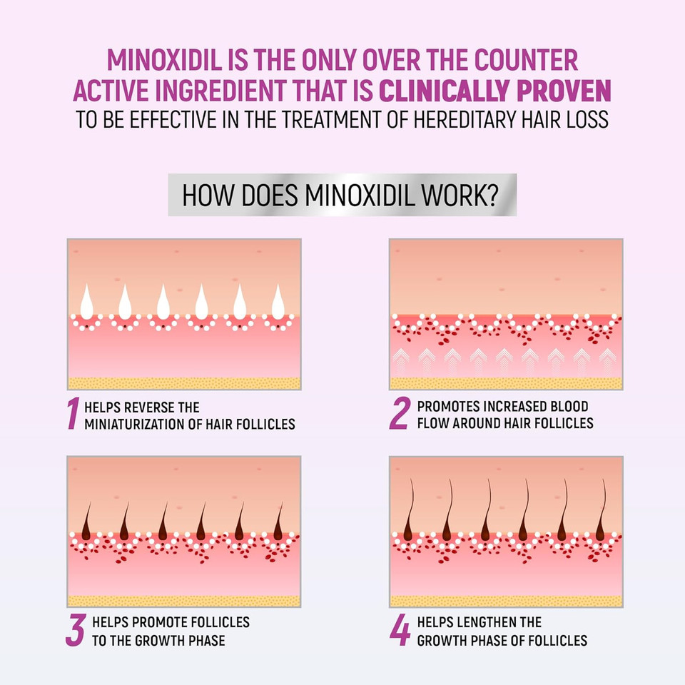 Taro Minoxidil For Women, 2.11 Oz (2 Months Supply) Clinically Proven To Regrow Hair, Topical Aerosol Foam 5%, Hair Thinning Treatment