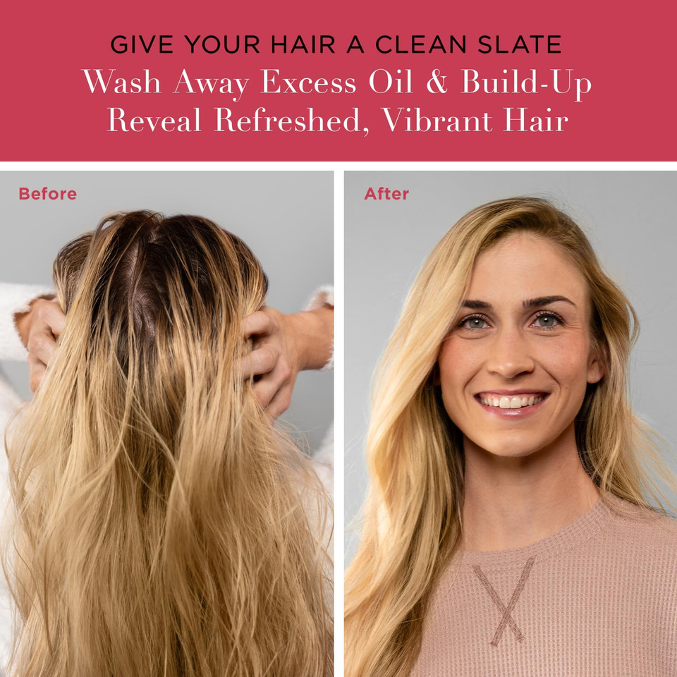 Unwash Anti-Residue Cleanse - Gentle, Ph-Balanced Clarifying Shampoo For Build Up Dirt And Oil, Safe For All Hair Types, 10 Fl Oz