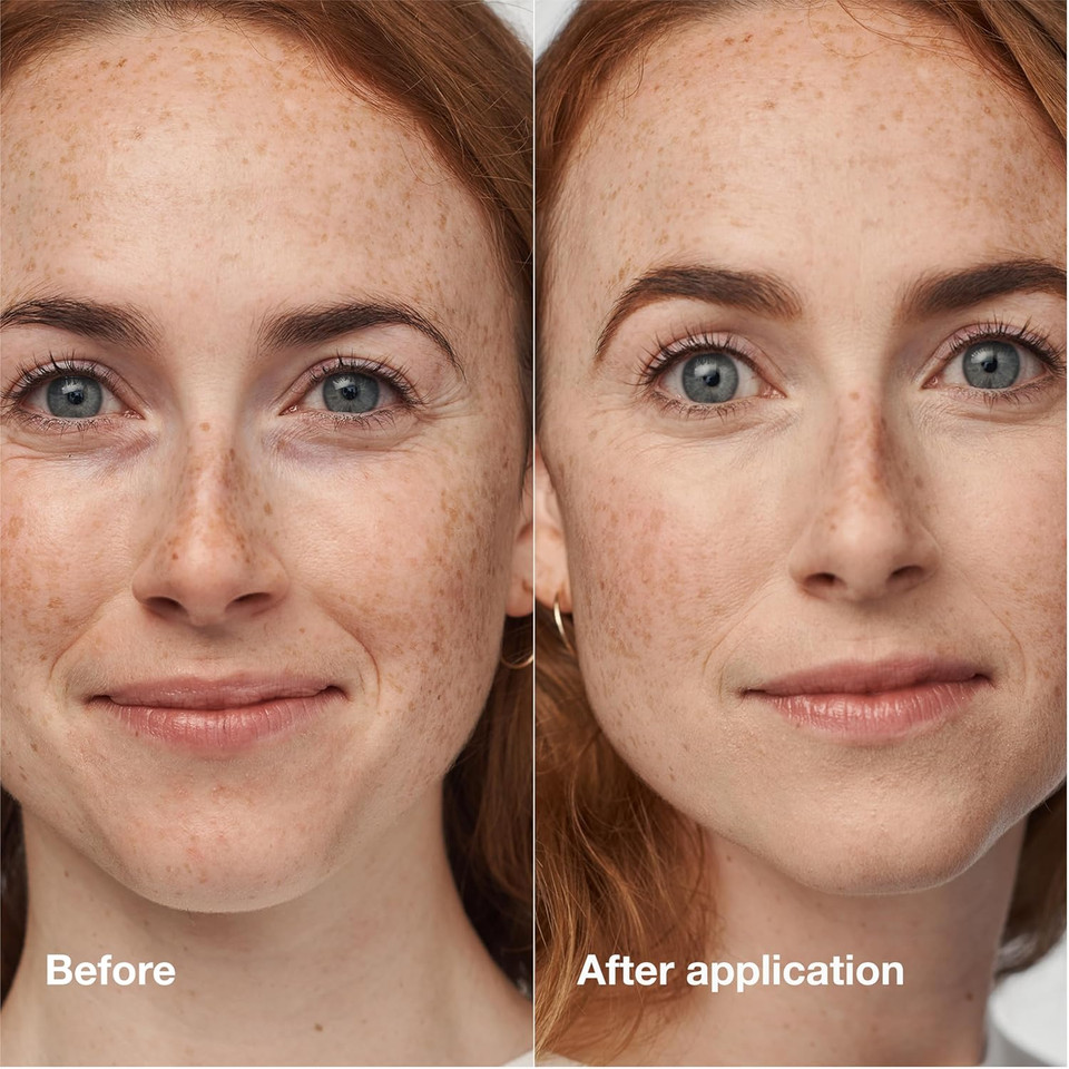 Clinique Even Better Clinical Serum Full Coverage Hydrating Foundation Broad Spectrum Spf 25 With Vitamin C, Salicylic Acid + Hyaluronic Acid For Oily Skin Types