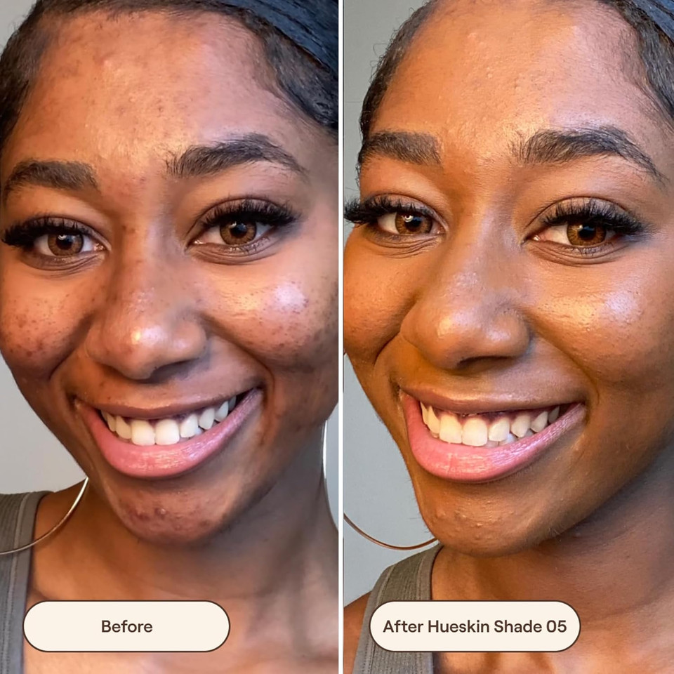 Live Tinted Hueskin Serum Concealer - Medium-To-Full Coverage Concealer With Niacinamide, & Hyaluronic Acid For Dark Circles, Fine Lines & Wrinkles, Buildable Long-Lasting Formula, 0.35 Oz - Shade 1