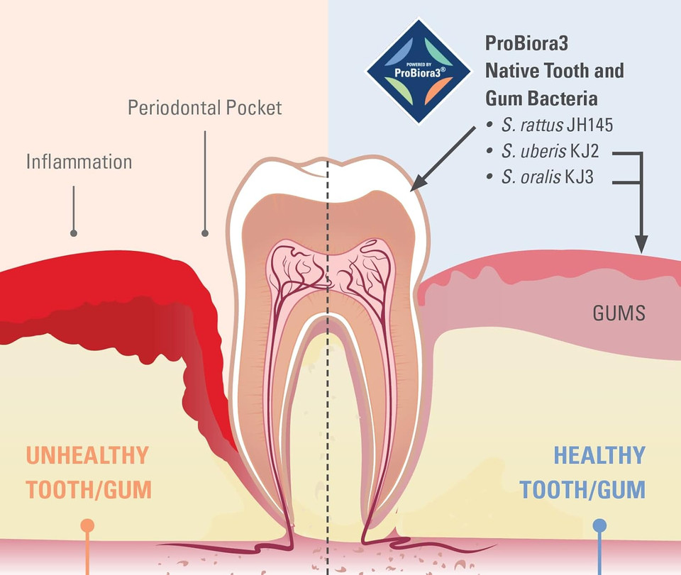 Probiora Oral-Care Chewable Probiotic Tablets | Probiotic Supplement For Women & Men | Healthier Teeth & Gums | Fresher Breath | Whiter Teeth | 60 Count | Mint
